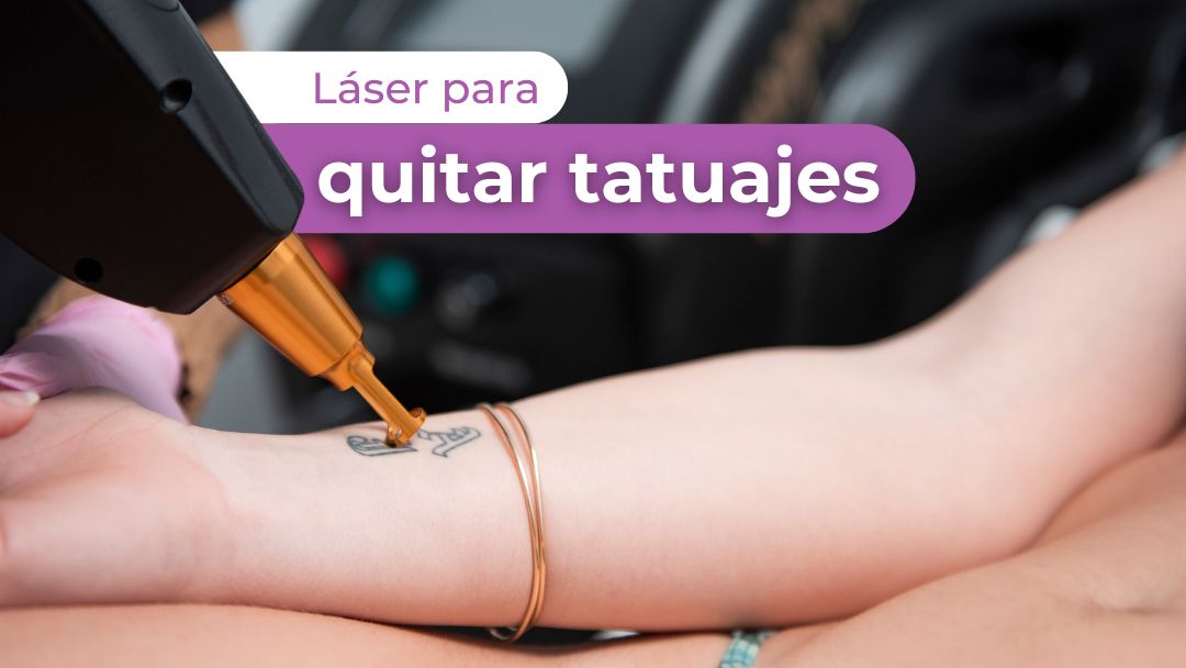 Láser para quitar tatuajes