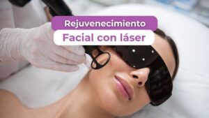 rejuvenecimiento-facial-con-láser
