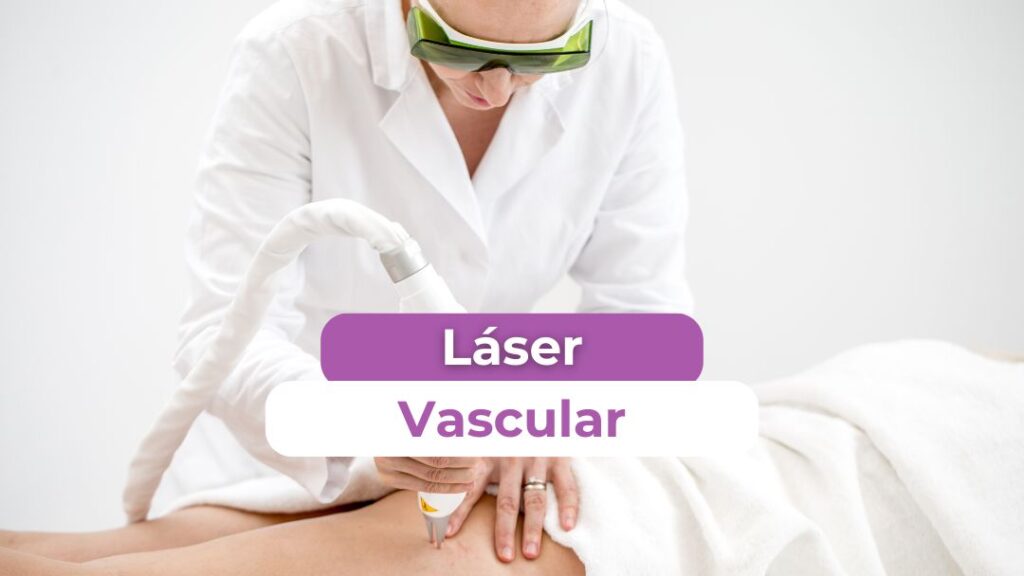 láser-vascular-guía-completa